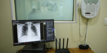 Diagnósticos evoluem, mas lei do imposto de renda ainda ignora doenças